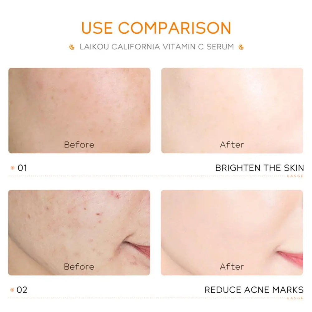 Moisturizing Vitamin C Serum Shrink Pores Whitening Brightning Face Repair Essence Women Face Skin Care Product